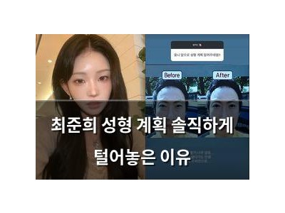 최준희 성형 계획 솔직하게 털어놓은 이유